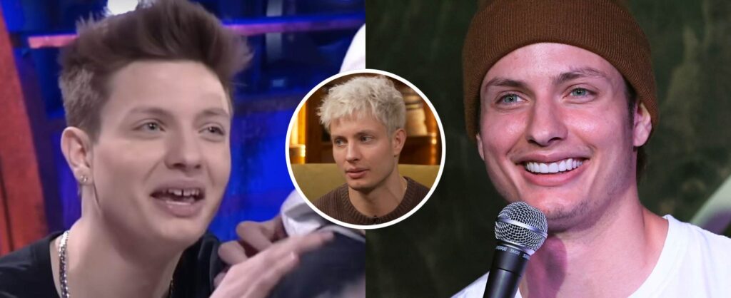 Comedian Matt Rife Addresses Plastic Surgery Claims, Admits Shelling ...